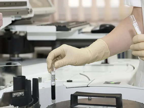 doctor holding tube of fluid