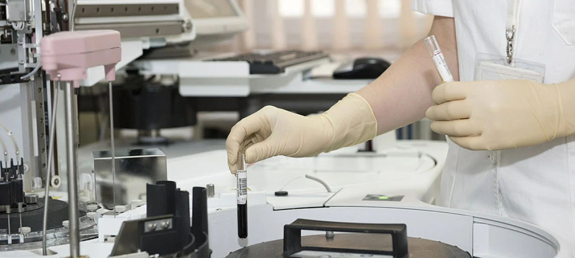 doctor holding tube of fluid